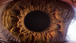 مقایسه رزولوشن واقعی چشم انسان با دوربین مداربسته